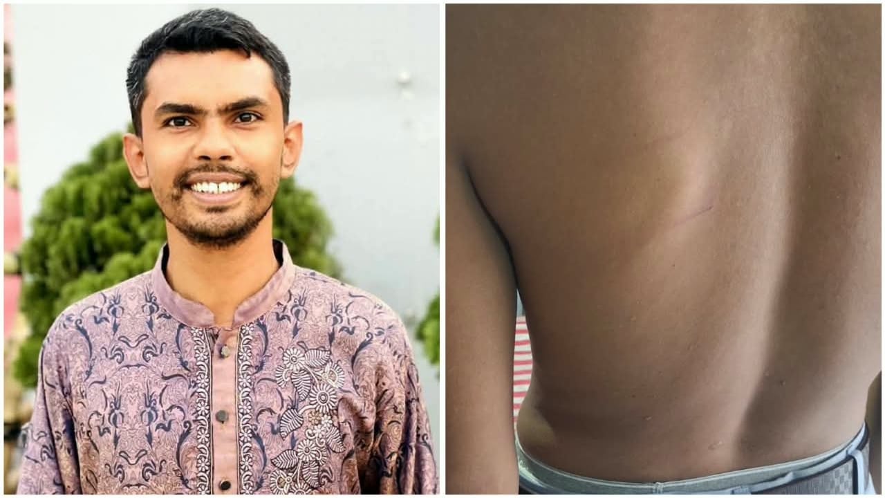 ছাত্র অধিকারকর্মীকে নির্যাতন, ছাত্রদল নেতার বিরুদ্ধে থানায় অভিযোগ