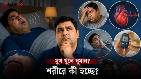 মুখ খুলে ঘুমান? শরীরে হতে পারে যেসব বিপদ!