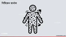 হামের প্রাদুর্ভাবে মৃত্যু বেড়ে ১০৪৬