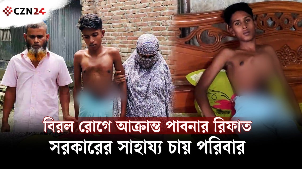 
বিরল রোগে আক্রান্ত পাবনার রিফাত, সরকারের সাহায্য চায় পরিবার