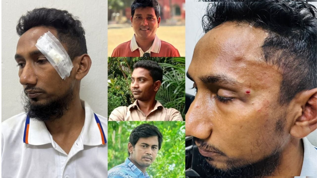 ছাত্রদল নেতার বিরুদ্ধে কর্মচারীকে মারধরের অভিযোগ, নিউজ করলে ‘দেখে নেওয়ার’ হুমকি