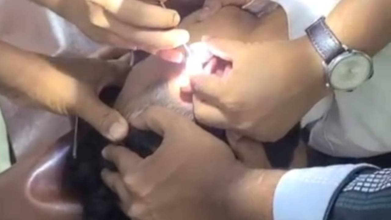 পটুয়াখালীতে কানে ইয়াবা লুকিয়ে ৯ দিন পর ধরা পড়লো যুবক