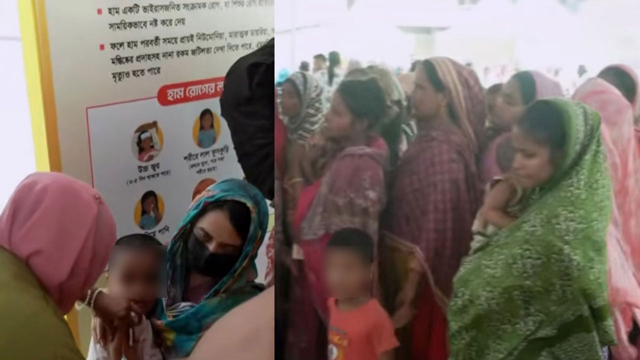 ডিএনসিসির যেসব স্থানে হামের টিকা দেওয়া হচ্ছে