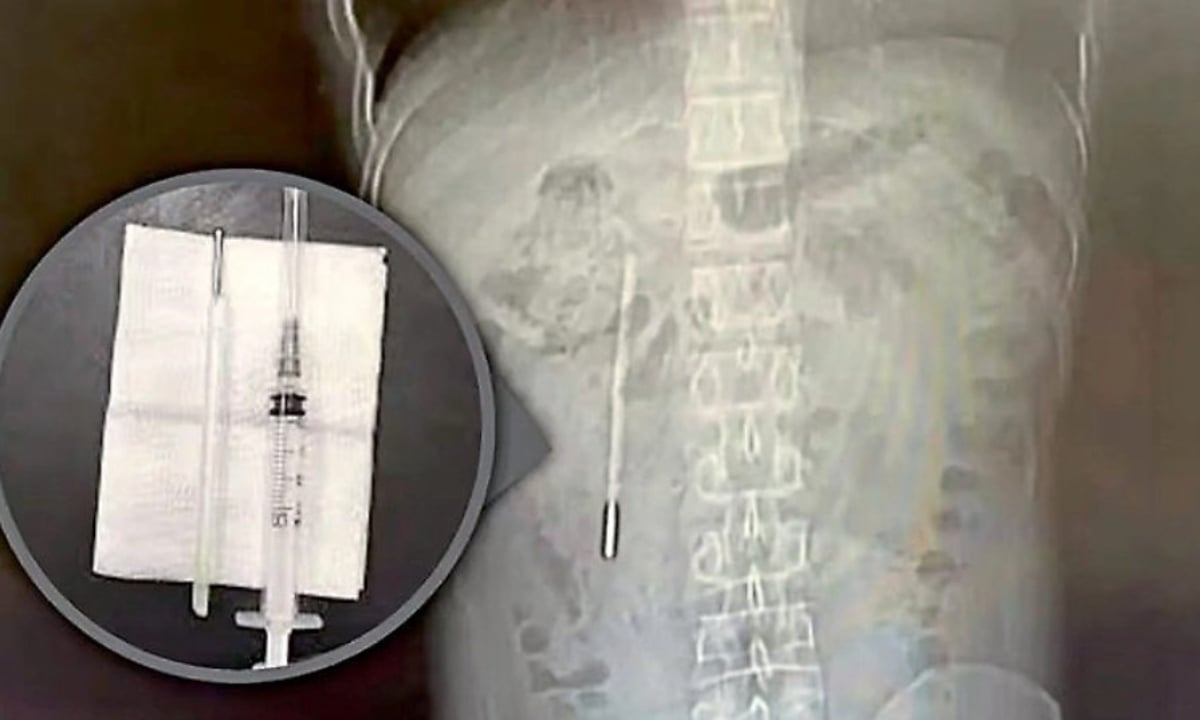 দুই দশক ধরে তরুণের পেটে থার্মোমিটার